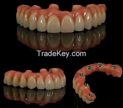 China Screw Implant Crown And Cridge Manufacturers Factory Suppliers