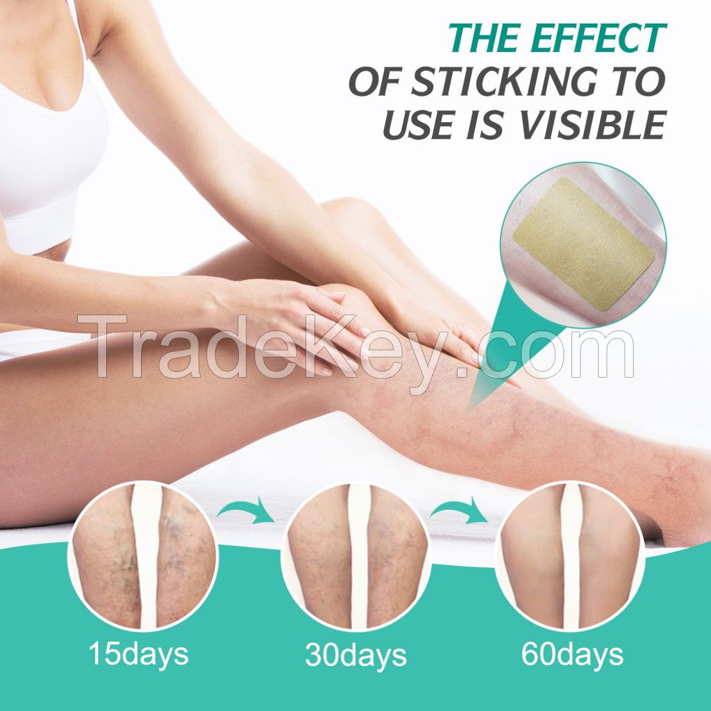 Spider Veins Removal Patch for Legs,Varicose Veins Treatment for Legs,Relieving Pain and Improving Blood Flow