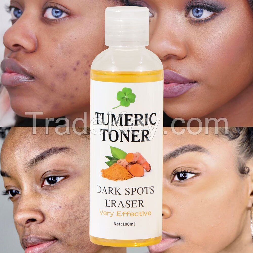 Alcohol-Free Hydrating Turmeric Facial Toner for Dark Spot Removal, Soothing and Brightening