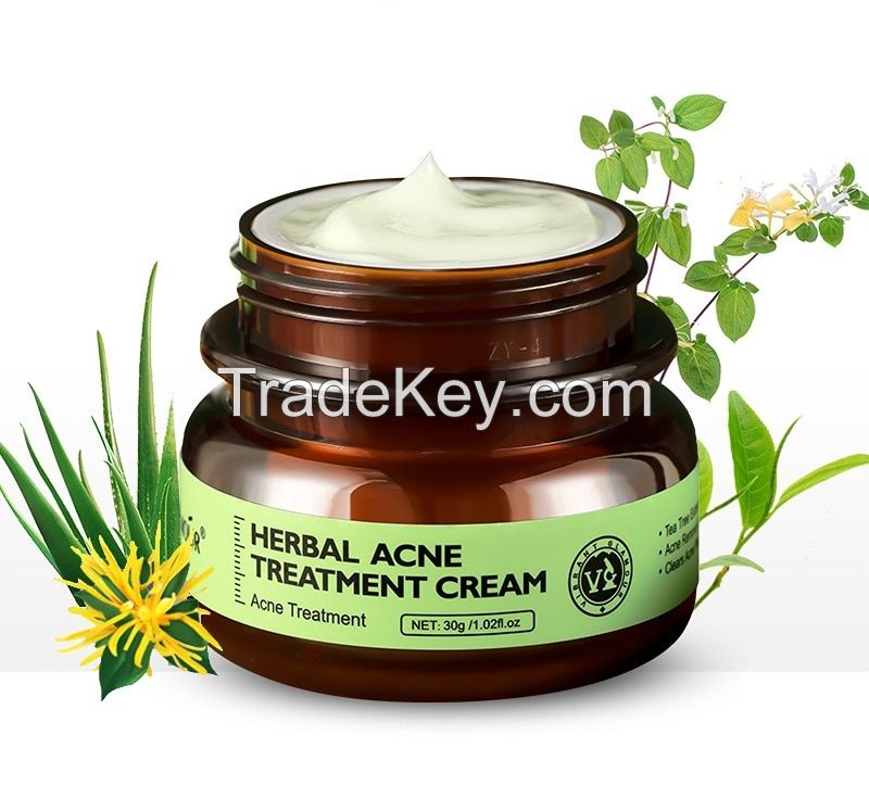 Herbal Acne Treatment Extra Strength Acne Pimple Cream & Lotion