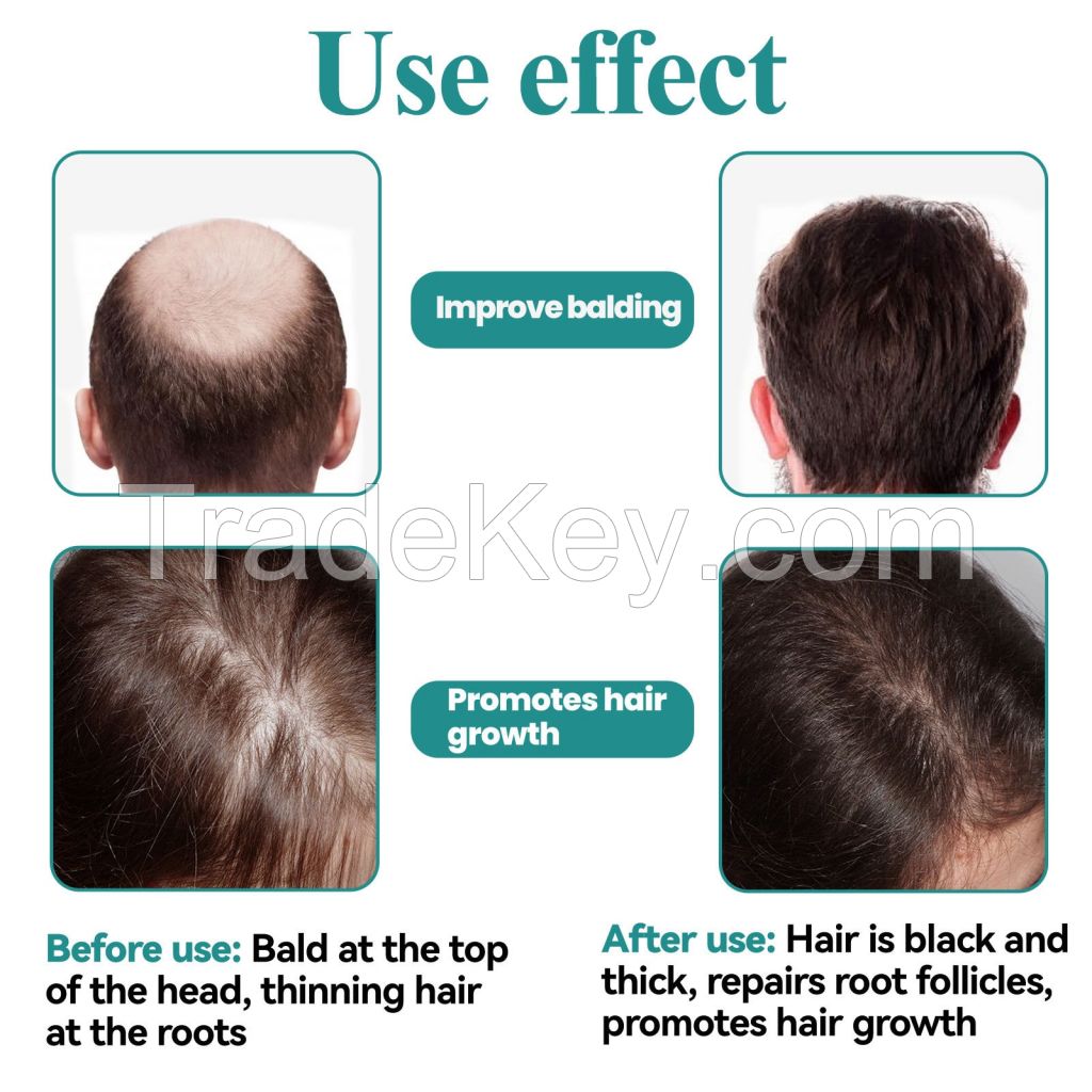 Hair Treatment Moisturizing Thickening Anti-Hair Loss Hair Care Essence