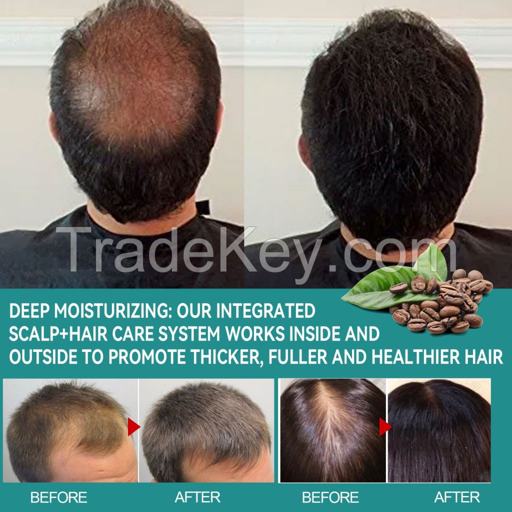 Hair Treatment Moisturizing Thickening Anti-Hair Loss Hair Care Essence