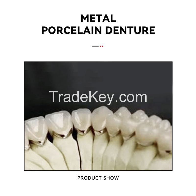 Metal Porcelain Denture - Major Brand