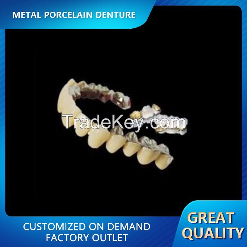 Metal Porcelain Denture - Major Brand