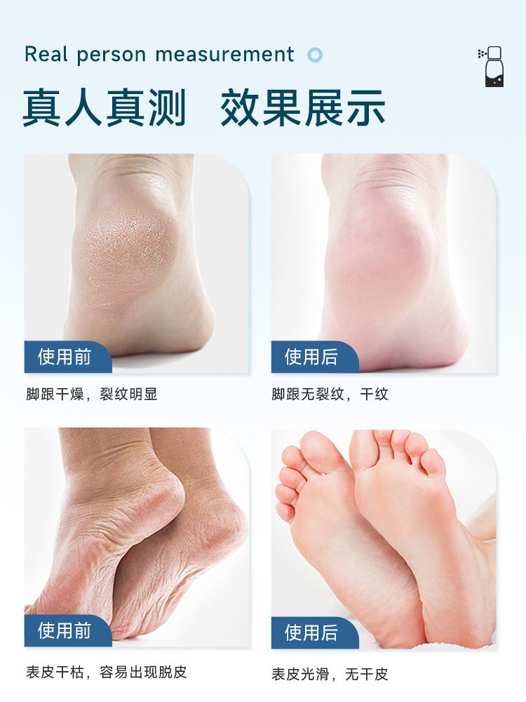 Mugwort Herbal Antibacterial Spray unit for foot healthy Shoe Deodorant Eliminates Unpleasant Odor Foot Deodorant Odor Spray Eliminates Odor Anti Bacterial