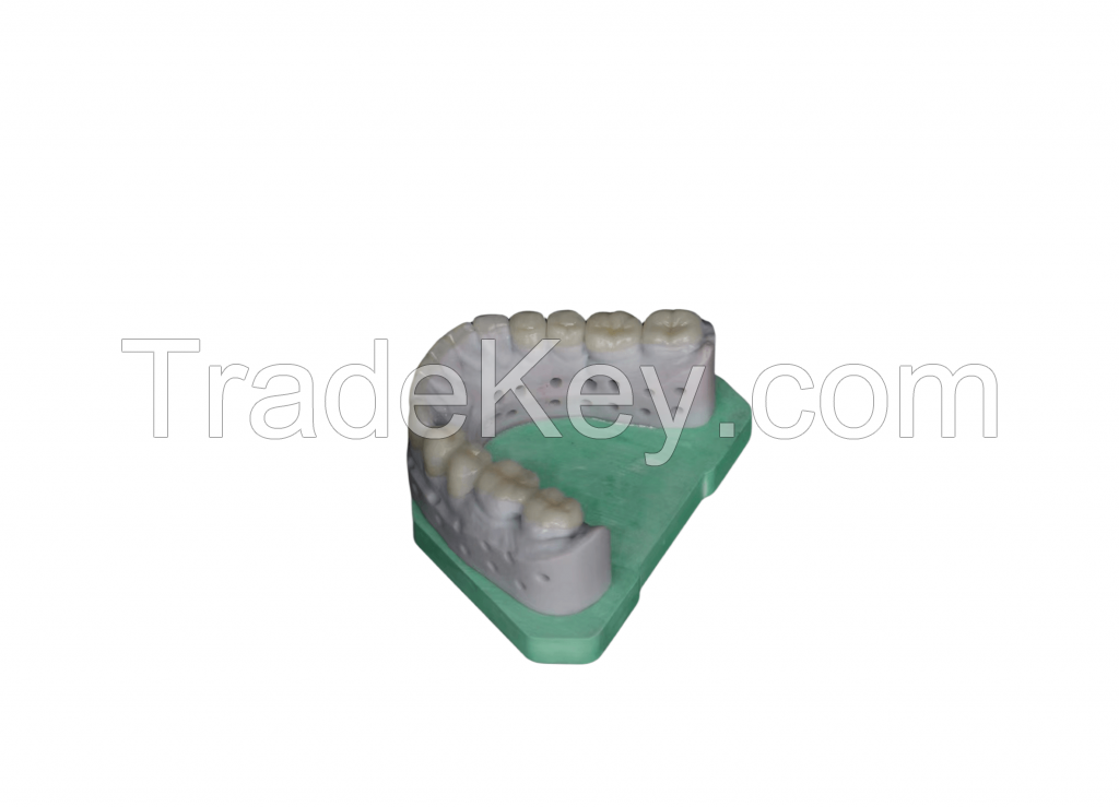 Dental temporary crown resin, high-strength and high toughness tempora