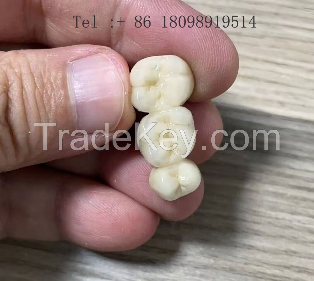 Zirconia Crown Outsource To China