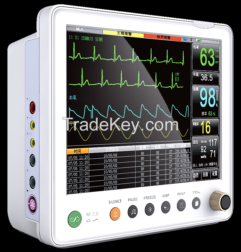 Veterinary Multiple Parameters Patient Monitor