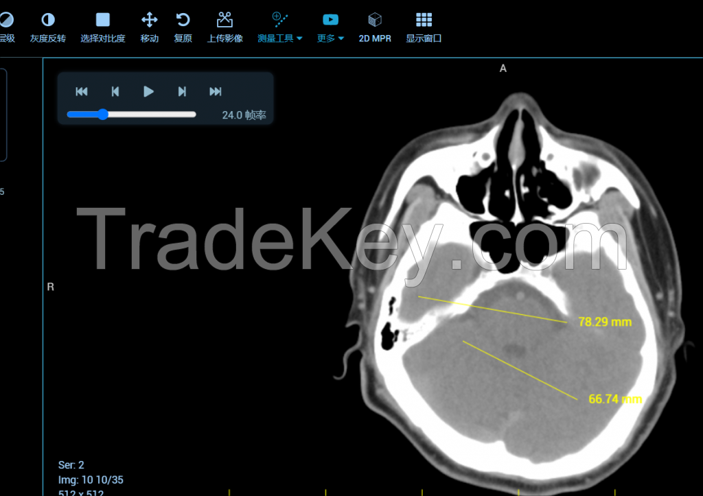 B/S PACS Imaging and Video system 