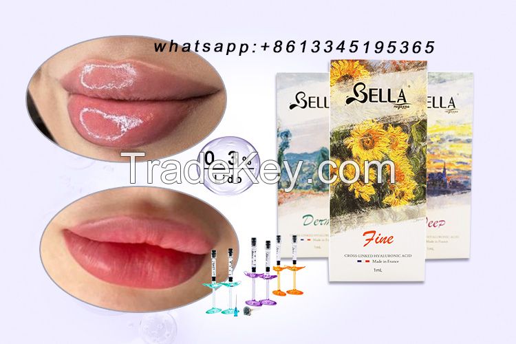 Hot sale new arrival  Bella cross-linked sodium hyaluronate gel Hyaluronic acid injections for lip enhancement