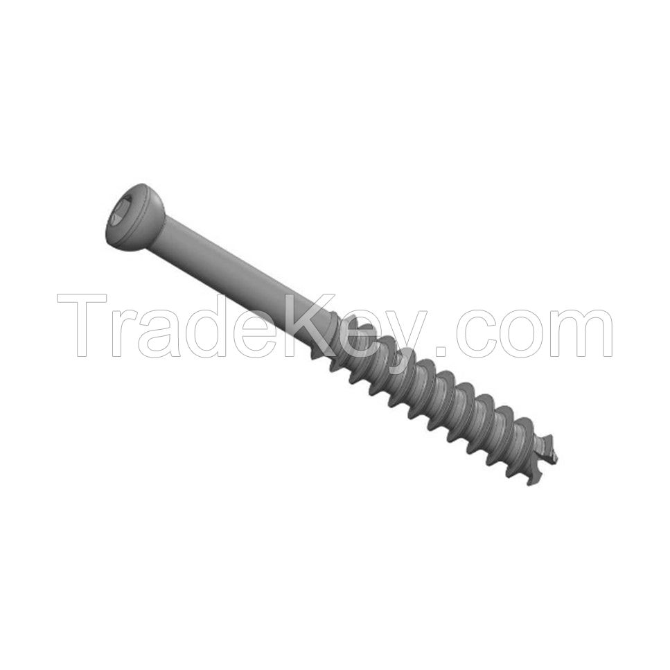 Bone screw ( Orthopedic Implants ) DEDANIA OVERSEAS { dedania AT gmail DOT com }