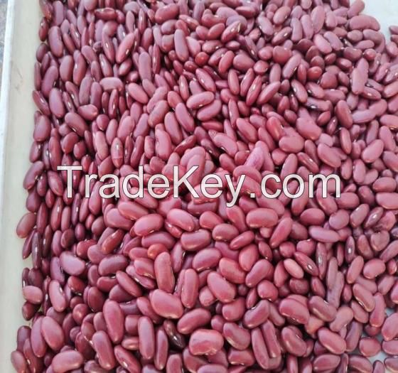 Black Kidney Beans/White Kidney Beans/Red Kidney Beans/Speckled Kidney Beans/Haricot Beans