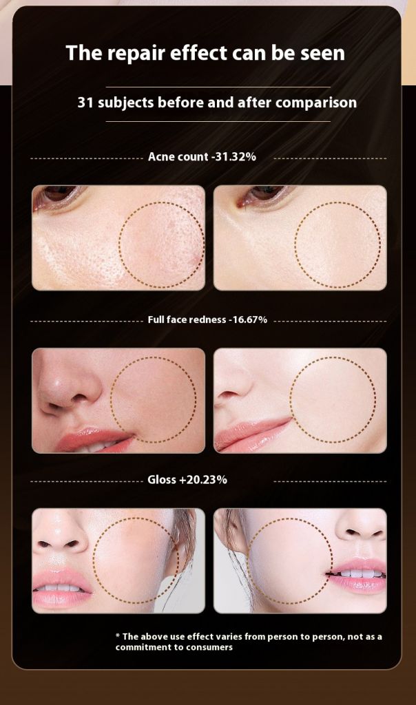 App Control Wholesale High Quality Red Led Therapy Light Helmet Device Therapy For Hair Growth Cap