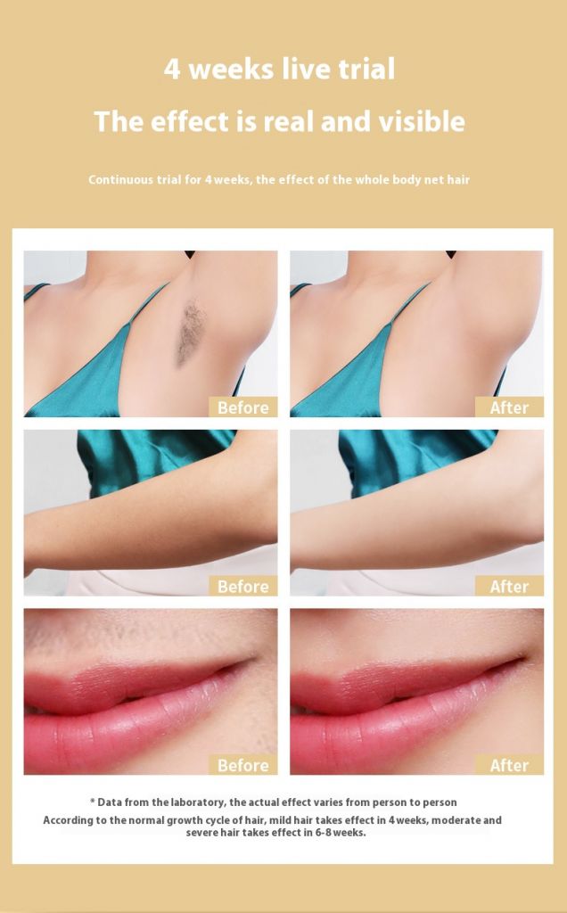 Women Man Diode Painless Body Dark Skin Epilator Machine Home Use Mini Portable Permanent Hair Removal