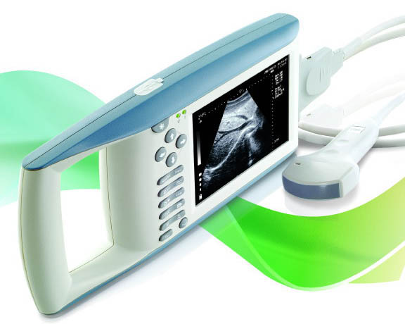 DIGITAL Palmtop Ultrasound Scanner