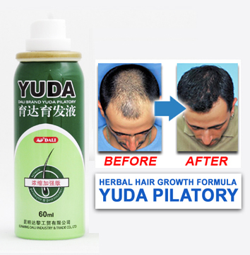 Effective hair loss treatment and hair growth by-- yuda Pilatory