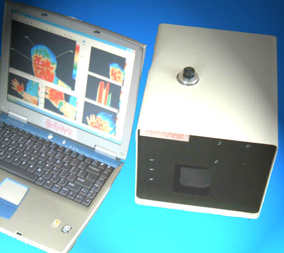 Teletherm infrared imager