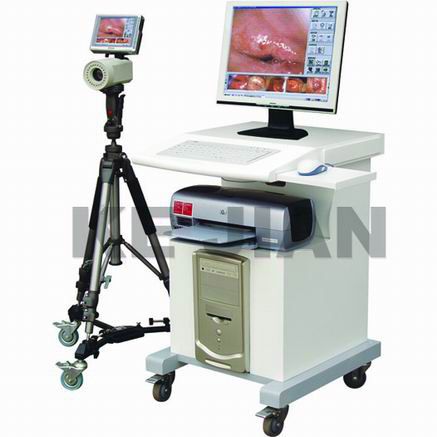 Colposcopy Medical Image Workstation (AD-2000Y Trolley Type)