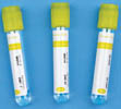 VACUUM BLOOD COLLECTION TUBE (SST tube)