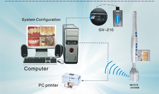 Dental Camera for Wireless USB model