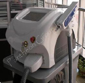 Yag Laser for Tattoo Removal