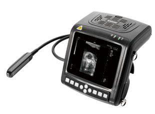 Ultrasound Scanner (KX5200V)