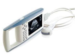 Palm Ultrasound Scanner