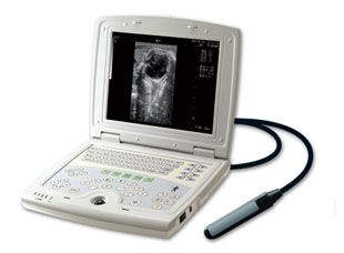 Laptop Ultrasound Scanner (KX5000)