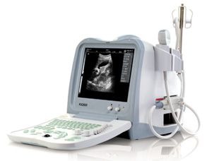 Digital Ultrasound Scanner (KX2600)