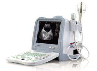 Full Digital B Mode Ultrasound Scanner (KX2600, 11 Edition)