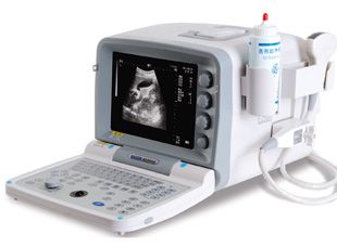 Portable Ultrasound Scanner (KX2000G, 09 Edition)