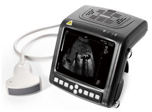 Full Digital B Mode Ultrasound Scanner (KX5200)
