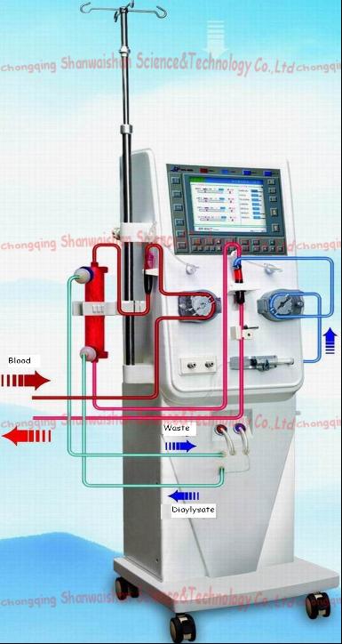 Hemodialysis Equipment