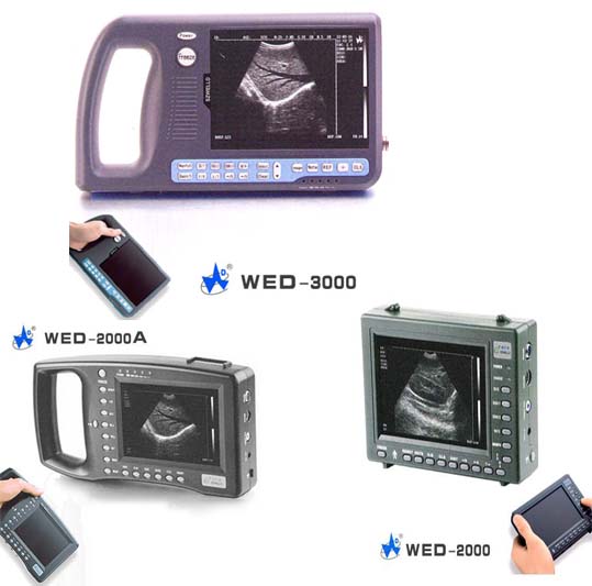 Ultrasound Scanner for Human and Vet Palmsize