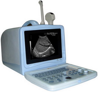 RUS-9000A Digital Portable Ultrasound Scanner