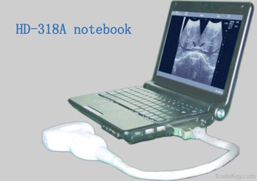 HD-318A notebook B ultrasound scanner black and white