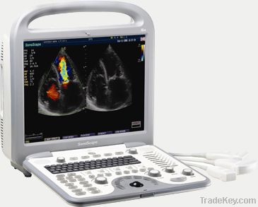 V3 Color Doppler B Ultrasound Scanner