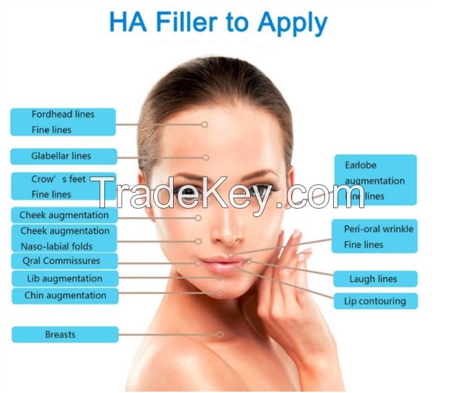 100%Pure Hyaluronic Acid Filler, Dermal Filler For Derm Deep Wrinkle