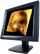 3D ultrasound video capture workstation software