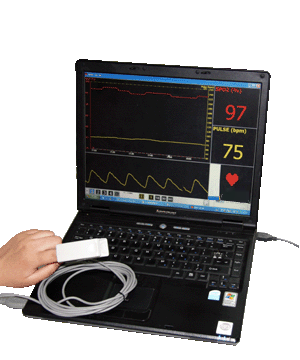 CMS-P PC Based Pulse Oximeter with Free SW