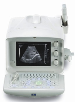Portable Ultrasound Diagnostic Equipment