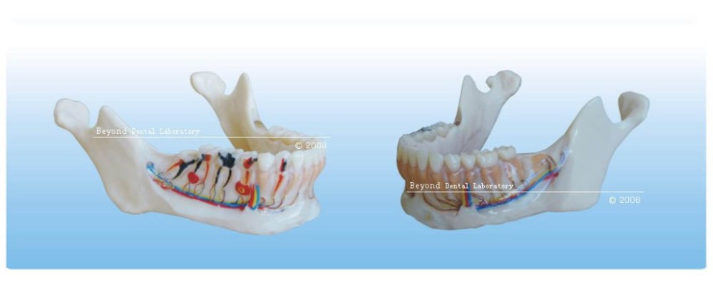 Acrylic Denture - Dental Study Model