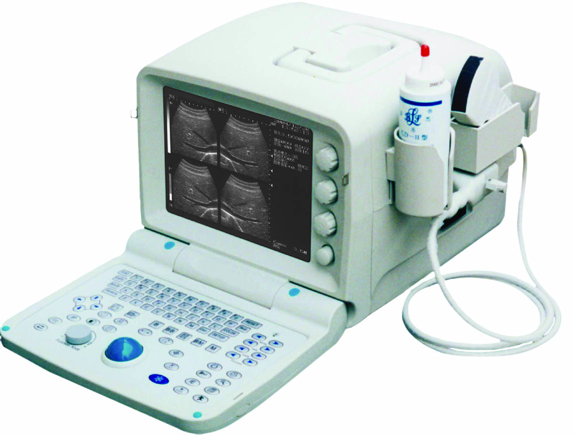 Portable convex ultrasound scanner(dual probe connector)