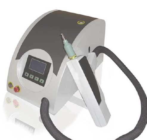 laser tattoo removal equipment