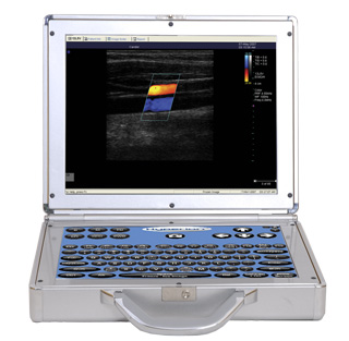 Hyperionâ¢ Ultrasound with dual touch-screens and wireless capabilities
