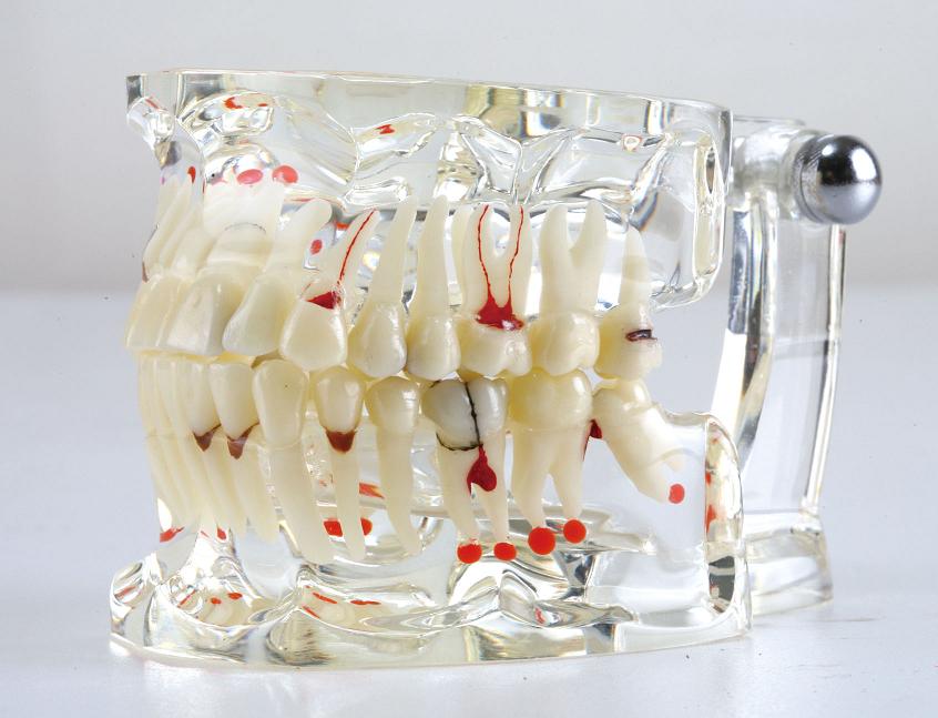 teeth model(TACRN)