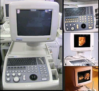 ultrasound scanner 4D medison Sonoace 8000 live mfg 2005