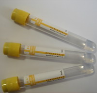 vacuum blood collection tube (Gel & Clot Activator Tube