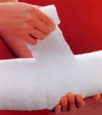 Plaster of Paris bandage