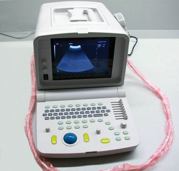 Portable Convex Ultrasound Scanner